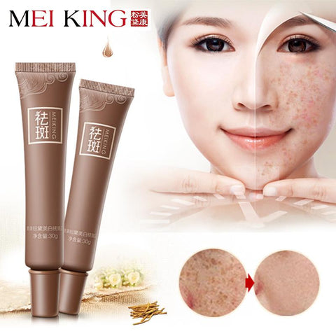 Dark Spot Corrector Skin Whitening Fade Cream Lightening Blemish Removal Serum Reduces Age Spots Freckles Melasma Face Cream