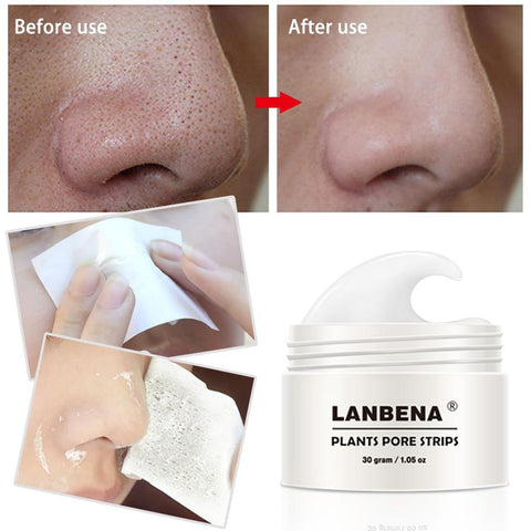 2017 New Style LANBENA Blackhead Remover Nose Mask Pore Strip Black Mask Peeling Acne Treatment Black Deep Cleansing Skin Care